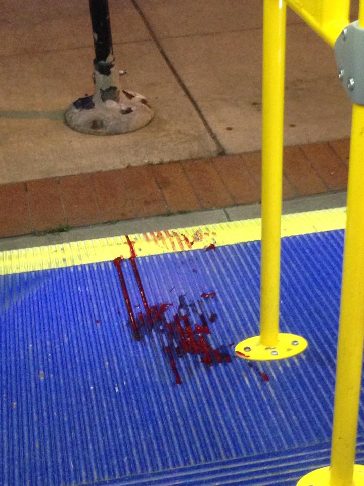 Bus evacuated due to blood pool near the exit